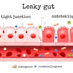 Lekkende darm, leaky gut, De EetLijn