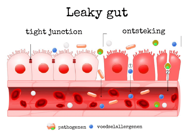 Lekkende darm, leaky gut, De EetLijn